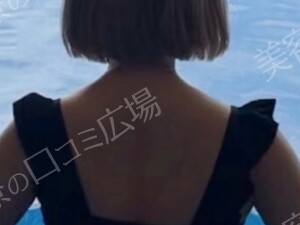 治療前の症例写真