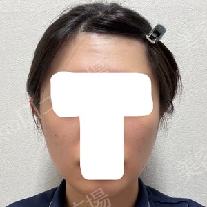 ギャラリークリニックの症例写真[アフター]