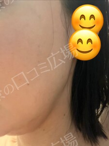 治療結果の症例写真