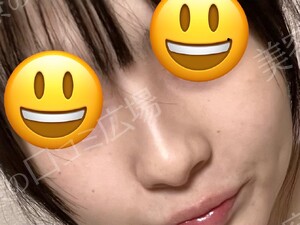 治療前の症例写真