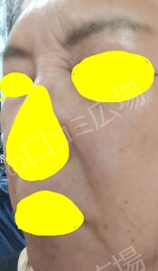 治療前の症例写真