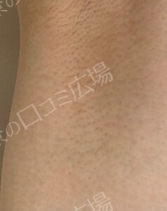 治療結果の症例写真