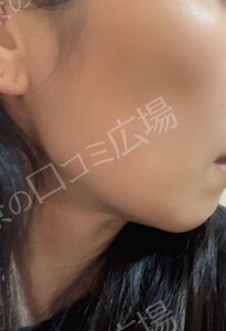 治療結果の症例写真