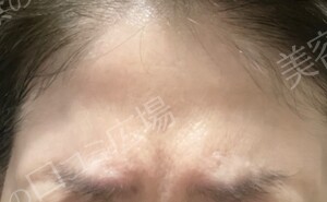 治療結果の症例写真