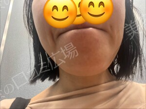 治療前の症例写真
