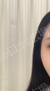 治療結果の症例写真
