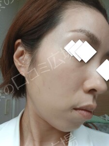 治療前の症例写真