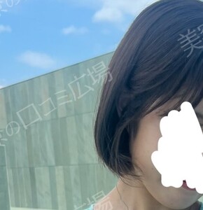 治療結果の症例写真