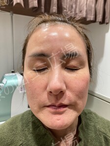 治療前の症例写真