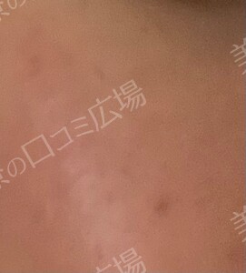 治療結果の症例写真