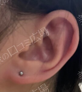 治療直後の症例写真
