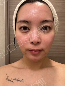 治療前の症例写真