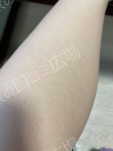 治療結果の症例写真