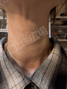治療前の症例写真