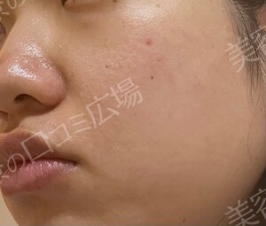 治療結果の症例写真