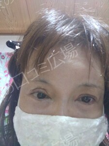 治療結果の症例写真