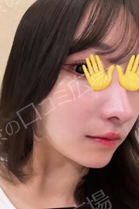 治療結果の症例写真