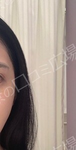 治療結果の症例写真