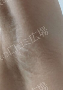 治療前の症例写真