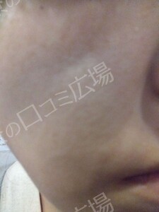 治療結果の症例写真