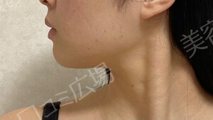治療結果の症例写真