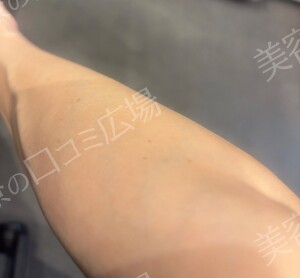 治療前の症例写真