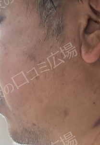治療前の症例写真