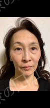 施術前の状態