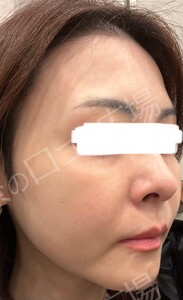 治療前の症例写真