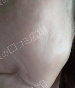 治療前の症例写真