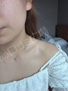 治療結果の症例写真