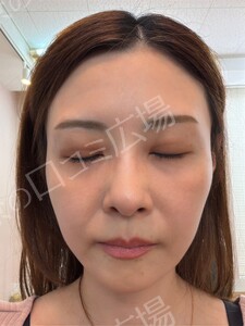治療結果の症例写真