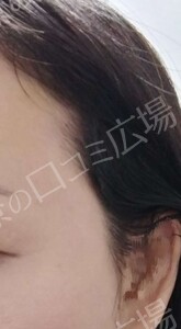 治療結果の症例写真
