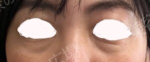 治療前の症例写真