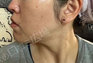 治療結果の症例写真