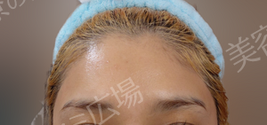 治療前の症例写真