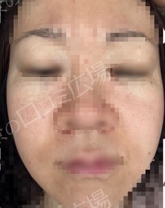 治療前の症例写真