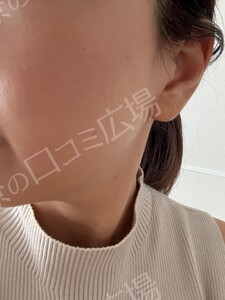 治療結果の症例写真