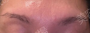 治療結果の症例写真