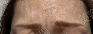 治療前の症例写真
