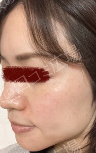 治療前の症例写真