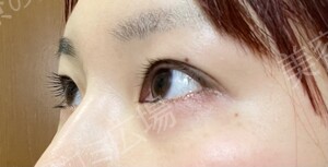 治療結果の症例写真