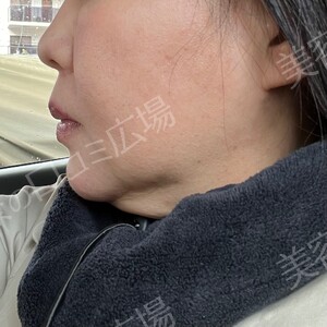 治療前の症例写真