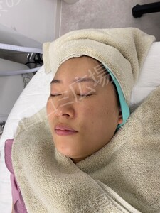 治療前の症例写真