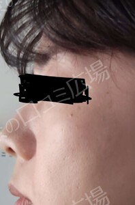 治療前の症例写真