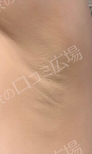 治療前の症例写真
