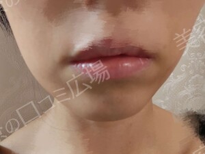 治療結果の症例写真