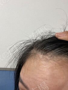 治療前の症例写真