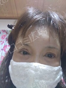 治療結果の症例写真