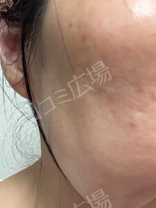 治療前の症例写真